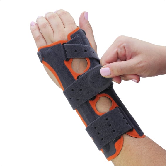 Splint Immobilization For Treatment of a Scapholunate Ligament Injury